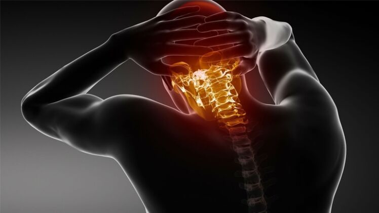 bol u stražnjem dijelu glave s cervikalnom osteohondrozom